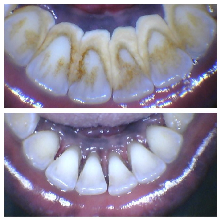 Gallery Woodbine Dental Hygiene